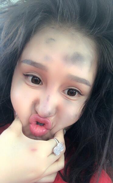 赵本山女儿晒自拍脸部皮肤饱满 看上去像充了气一样