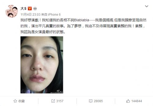 失踪人口大S产后开工，自嘲“脸僵”闹哪样？