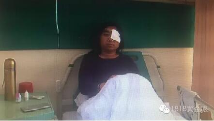 国产手机也爆了！奉化女子手机放胸口突然爆炸起火