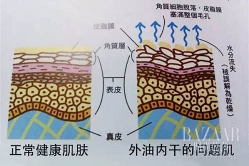 这天儿干的都能蜕层皮!天真的你以为换全套护肤品就能变水嫩?