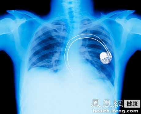 肺结核在北京呈高发势头 近半是流动人口患者