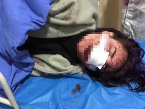 丽江通报-女子遭暴打-事件-6名嫌疑人被依法逮捕