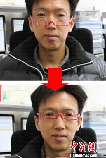 “双眼皮眼镜”受热捧医生称配戴不慎损伤眼皮（图）