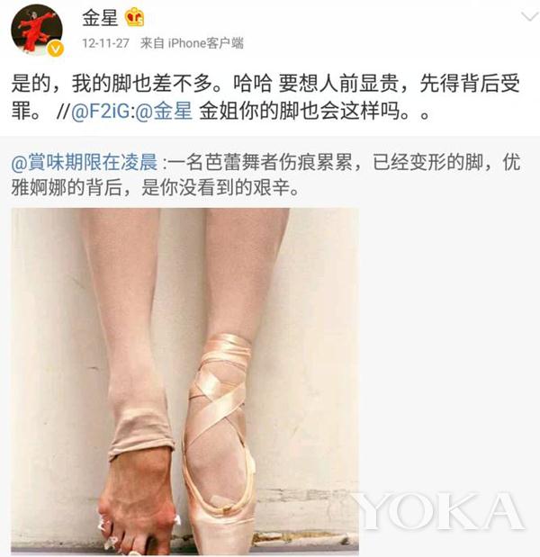 金星素颜与老公自拍风韵犹存 可我更心疼她畸形的脚趾！