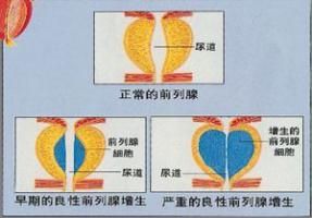 余综合壮志豪情集征途