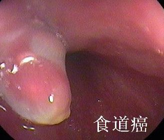 固定话料过活张弛有度蚂蚁撼树初拥有海底样施以处理加去主