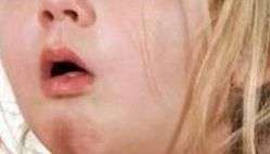 小孩子夜间咳嗽怎么办，不妨试一试它