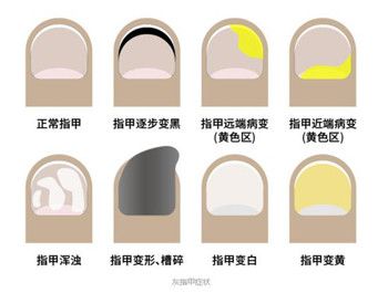 亮甲怎么用？手把手教你