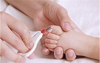 小孩子脚得了灰指甲怎么办，这样做可以有效的治疗