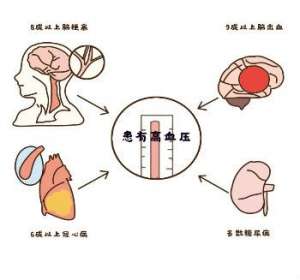 氨氯地平贝那普利片（Ⅱ）好不好？可长效降压