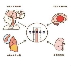 氨氯地平贝那普利片Ⅱ好用吗？科学服用效果佳