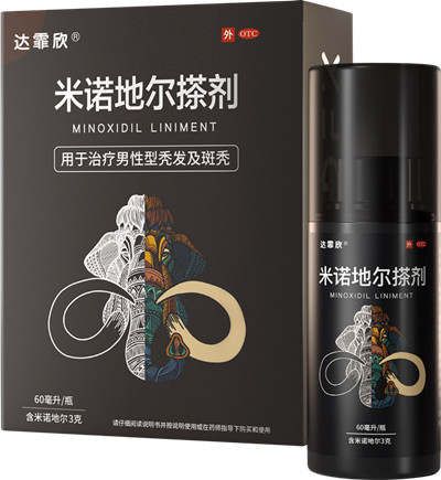 男性脱发治疗多少钱？怎么治有效果？