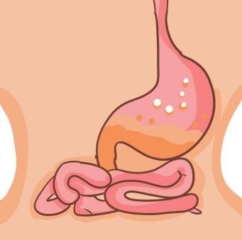 肠道敏感需要怎么做？