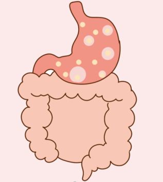 肠胃不舒服是什么原因引起的？多半与以下几点有关