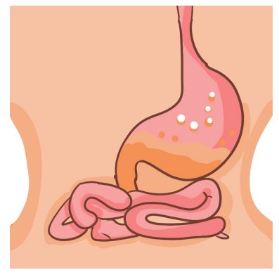 奥美拉唑胶囊吃多久一疗程？胃溃疡吃哪些食物有帮助？