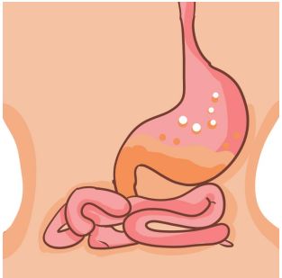 肠胃炎吃奥美拉唑有用吗？关于肠胃炎你了解多少？
