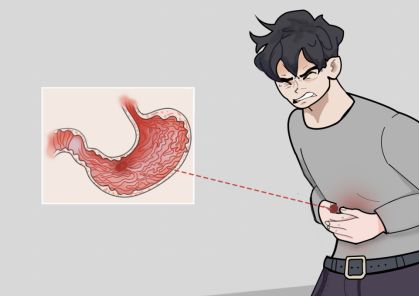 胃溃疡导致的胃疼吃奥美拉唑有用吗？
