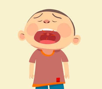 儿童咽炎吃再林阿莫西林颗粒有效吗？这种情况下适用！
