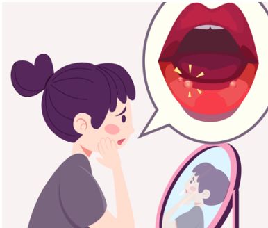 有一种痛，叫做“口腔溃疡”！口腔溃疡缺少哪种维生素？