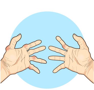 手指关节僵硬伸不直，吃什么药可以治疗关节僵硬？