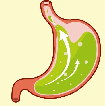 胃酸过多对胃肠健康不利，胃酸过多吃金奥康管用吗？