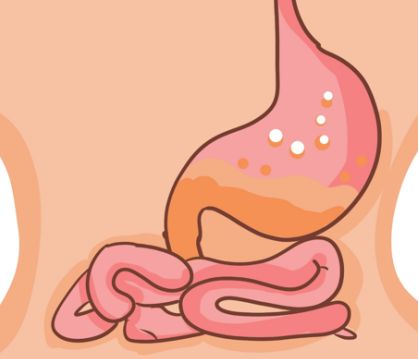 蒙脱石散可以用于胃溃疡吗？有治疗效果吗？